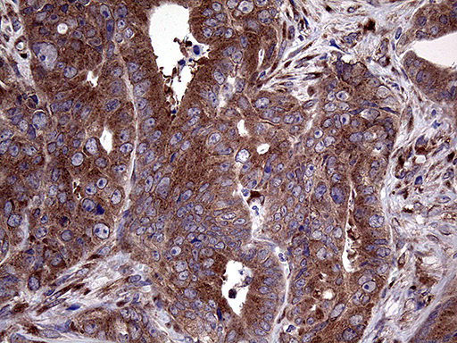 m05847 anti sec23b mouse monoclonal antibody clone id oti8g4 ihc testing 4