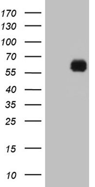 HEK293T cells were transfected with the pCMV6-ENTRY control (Left lane) or pCMV6-ENTRY KLF12 (Right lane) cDNA for 48 hrs and lysed