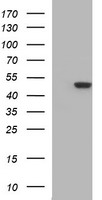 HEK293T cells were transfected with the pCMV6-ENTRY control (Left lane) or pCMV6-ENTRY TUBB2B (Right lane) cDNA for 48 hrs and lysed