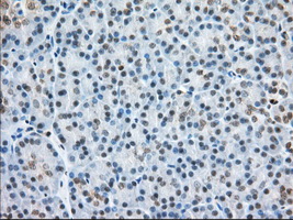 m05856 anti h6pd mouse monoclonal antibody clone id oti2a7 ihc testing 4