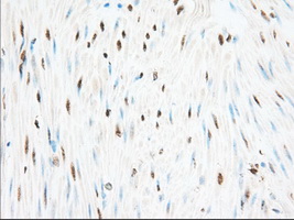 m05856 anti h6pd mouse monoclonal antibody clone id oti2a7 ihc testing 6