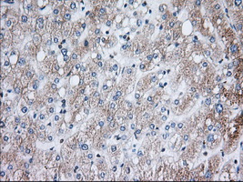 m05856 anti h6pd mouse monoclonal antibody clone id oti2a7 ihc testing 7