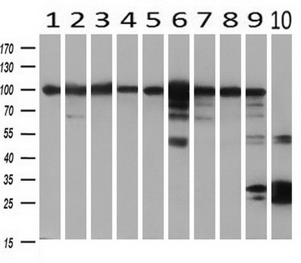 m05856 anti h6pd mouse monoclonal antibody clone id oti2a7 wb testing 2