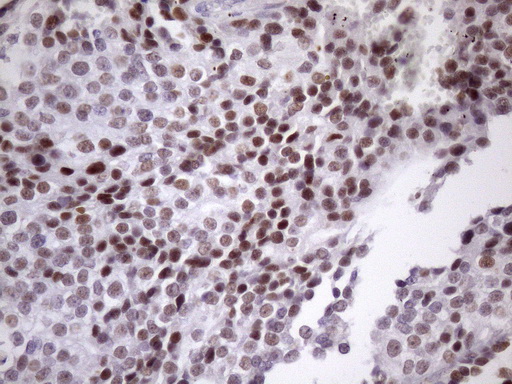 m05860 anti sfrs9 srsf9 mouse monoclonal antibody clone id oti5g7 ihc testing 10