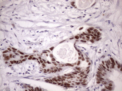 m05860 anti sfrs9 srsf9 mouse monoclonal antibody clone id oti5g7 ihc testing 11