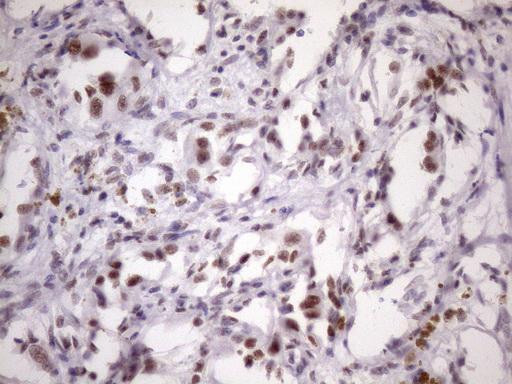 m05860 anti sfrs9 srsf9 mouse monoclonal antibody clone id oti5g7 ihc testing 13