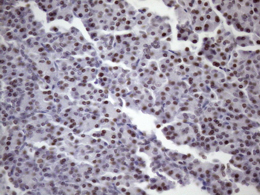 Immunohistochemical staining of paraffin-embedded Human pancreas tissue within the normal limits using anti-SRSF9 mouse monoclonal antibody