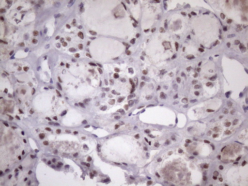 m05860 anti sfrs9 srsf9 mouse monoclonal antibody clone id oti5g7 ihc testing 6