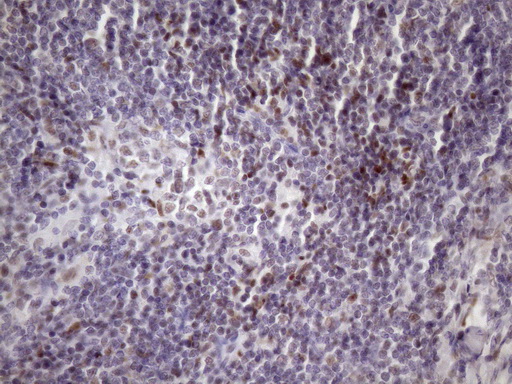 m05860 anti sfrs9 srsf9 mouse monoclonal antibody clone id oti5g7 ihc testing 9