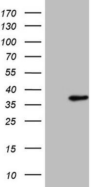HEK293T cells were transfected with the pCMV6-ENTRY control (Left lane) or pCMV6-ENTRY SRSF9 (Right lane) cDNA for 48 hrs and lysed
