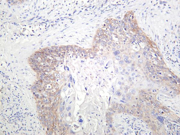 m05865 3 golga2 primary antibodies ihc testing 1
