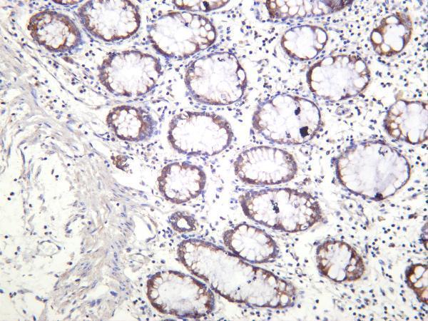 m05865 3 golga2 primary antibodies ihc testing 2