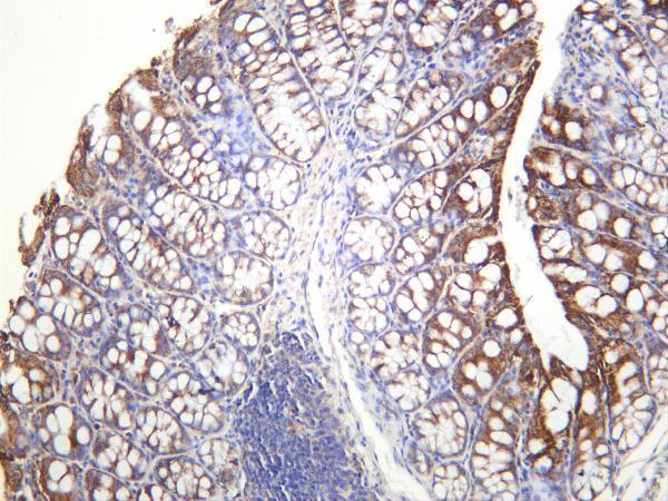 m05865 3 golga2 primary antibodies ihc testing 3