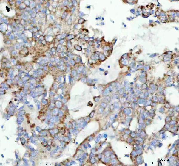 m05865 gm130 primary antibodies ihc testing 2