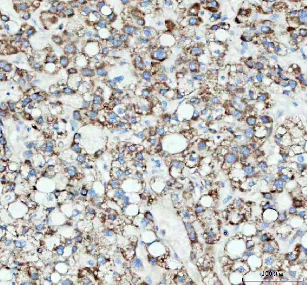 m05865 gm130 primary antibodies ihc testing 3