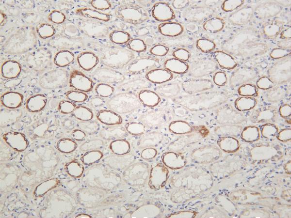 m05867 2 ndufs3 primary antibodies ihc testing 1