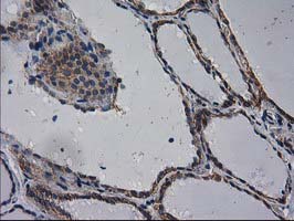 Immunohistochemical staining of paraffin-embedded Human thyroid tissue within the normal limits using anti-EIF4E2 mouse monoclonal antibody