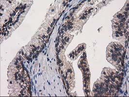 m05869 1 anti eif4el3 eif4e2 mouse monoclonal antibody clone id oti1f11 ihc testing 4