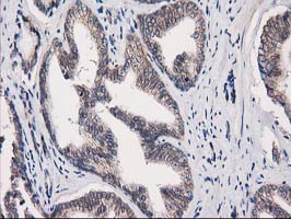 m05869 1 anti eif4el3 eif4e2 mouse monoclonal antibody clone id oti1f11 ihc testing 5