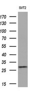 Western blot analysis of extracts (10ug) from 1 cell line by using anti-EIF4E2 monoclonal antibody (1:200)