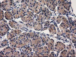 Immunohistochemical staining of paraffin-embedded Human pancreas tissue within the normal limits using anti-EIF4E2 mouse monoclonal antibody