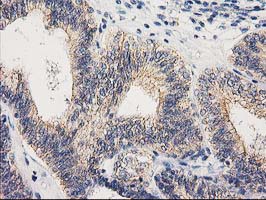 m05869 anti eif4el3 eif4e2 mouse monoclonal antibody clone id oti1f2 ihc testing 5