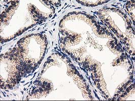 m05869 anti eif4el3 eif4e2 mouse monoclonal antibody clone id oti1f2 ihc testing 6