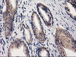 m05869 anti eif4el3 eif4e2 mouse monoclonal antibody clone id oti1f2 ihc testing 7
