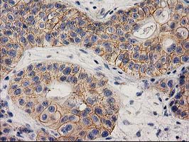 m05869 anti eif4el3 eif4e2 mouse monoclonal antibody clone id oti1f2 ihc testing 8