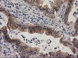 m05869 anti eif4el3 eif4e2 mouse monoclonal antibody clone id oti1f2 ihc testing 9