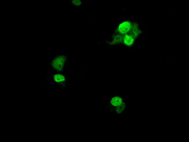 Anti-UBE2T mouse monoclonal antibody (M05874) immunofluorescent staining of COS7 cells transiently transfected by pCMV6-ENTRY UBE2T