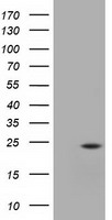HEK293T cells were transfected with the pCMV6-ENTRY control (Left lane) or pCMV6-ENTRY UBE2T (Right lane) cDNA for 48 hrs and lysed