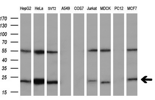 Western blot analysis of extracts (35ug) from 9 different cell lines by using anti-UBE2T monoclonal antibody (HepG2: human; HeLa: human; SVT2: mouse; A549: human; COS7: monkey; Jurkat: human; MDCK: canine; PC12: rat; MCF7: human) (1:200)