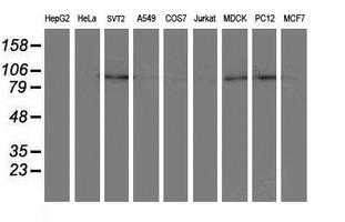 m05875 anti dpp8 mouse monoclonal antibody clone id oti1d2 wb testing 3