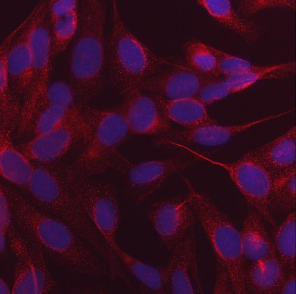  IF analysis of NDP52/CALCOCO2 using anti-NDP52/CALCOCO2 antibody (M05876-2)