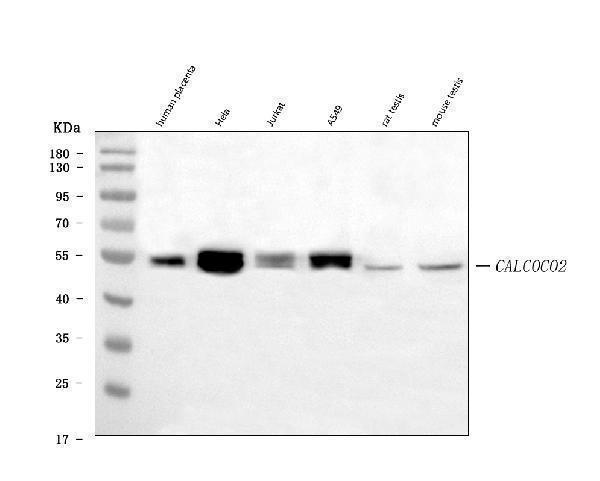  Western blot analysis of NDP52/CALCOCO2 using anti-NDP52/CALCOCO2 antibody (M05876-2)
