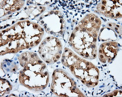 m05891 anti nit2 mouse monoclonal antibody clone id oti3d5 ihc testing 5