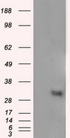 HEK293T cells were transfected with the pCMV6-ENTRY control (Left lane) or pCMV6-ENTRY NIT2 (Right lane) cDNA for 48 hrs and lysed