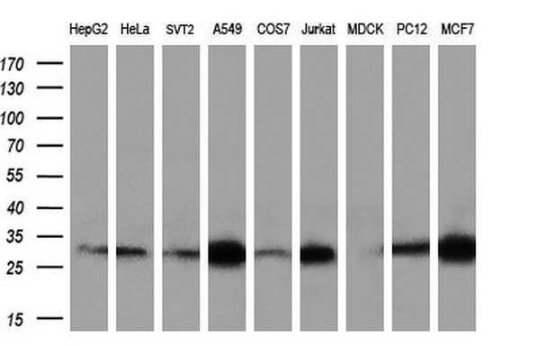 Western blot analysis of extracts (35ug) from 9 different cell lines by using anti-NIT2 monoclonal antibody (HepG2: human; HeLa: human; SVT2: mouse; A549: human; COS7: monkey; Jurkat: human; MDCK: canine; PC12: rat; MCF7: human) (1:200)