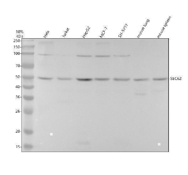 Western blot analysis of SEC62 using anti-SEC62 antibody (M05906)