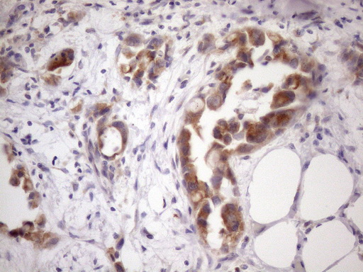 m05918 anti ssx2ip mouse monoclonal antibody clone id oti5c3 ihc testing 4