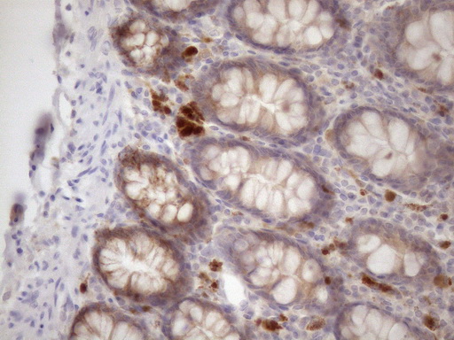 m05918 anti ssx2ip mouse monoclonal antibody clone id oti5c3 ihc testing 5