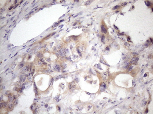 m05918 anti ssx2ip mouse monoclonal antibody clone id oti5c3 ihc testing 6