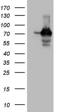 HEK293T cells were transfected with the pCMV6-ENTRY control (Left lane) or pCMV6-ENTRY SSX2IP (Right lane) cDNA for 48 hrs and lysed