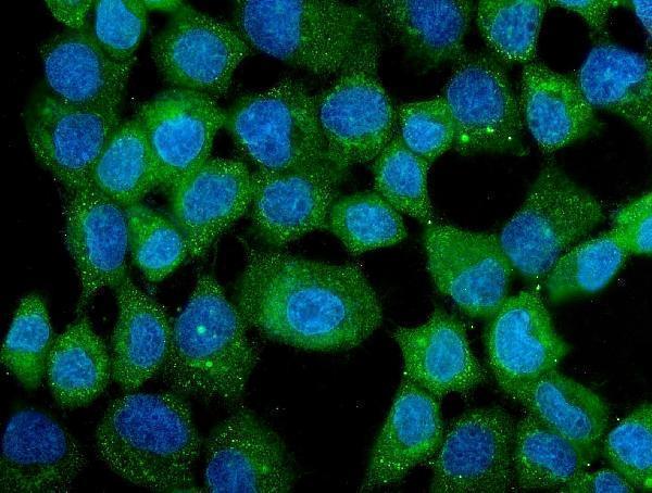 m05920 cct3 primary antibodies if testing 2