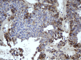 m05926 1 anti mipep mouse monoclonal antibody clone id oti4d11 ihc testing 4