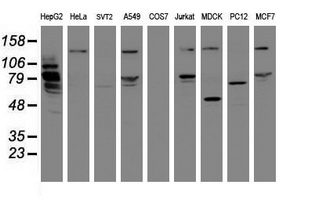 Western blot analysis of extracts (35ug) from 9 different cell lines by using anti-MIPEP monoclonal antibody (HepG2: human; HeLa: human; SVT2: mouse; A549: human; COS7: monkey; Jurkat: human; MDCK: canine; PC12: rat; MCF7: human)