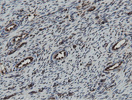 Immunohistochemical staining of paraffin-embedded Human Ovary tissue within the normal limits using anti-MIPEP mouse monoclonal antibody