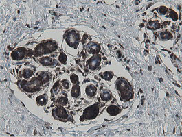 m05926 anti mipep mouse monoclonal antibody clone id oti5e7 ihc testing 7