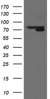 HEK293T cells were transfected with the pCMV6-ENTRY control (Left lane) or pCMV6-ENTRY MIPEP (Right lane) cDNA for 48 hrs and lysed